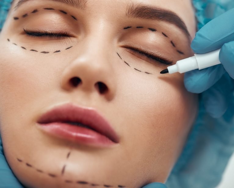 Becoming perfect. Close up photo of young woman with glowing skin in blue medical hat waiting for facial surgery while plastic surgeon in blue gloves drawing dashed line under eyes. Beauty concept. Facelift. Plastic surgery