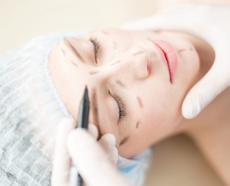 Doctor marking eye areas with black highlighter on face of young patient